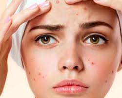 Cuticare skin & cosmetology Centre in trichy,best quality yet affordable skin & cosmetology services to everyone